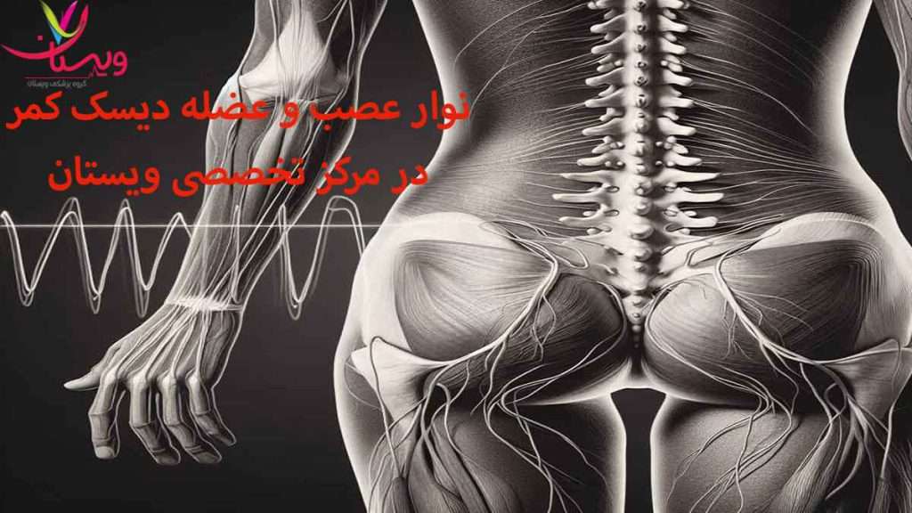 نوار عصب کمر