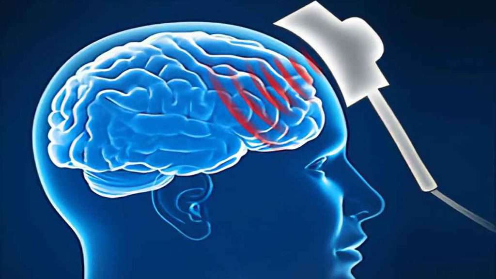 تحریک مغز چیست؟