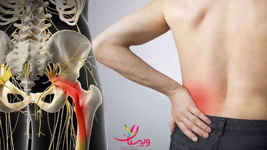 نحوه گرفتن نوار عصب