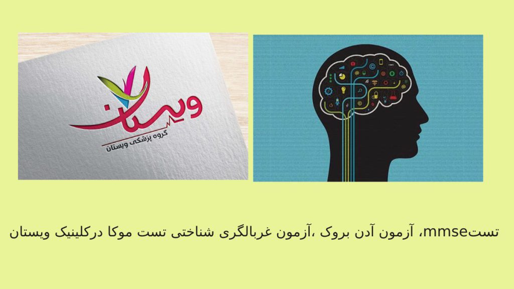 انجام انواع  تست حافظه در کلینیک ویستان