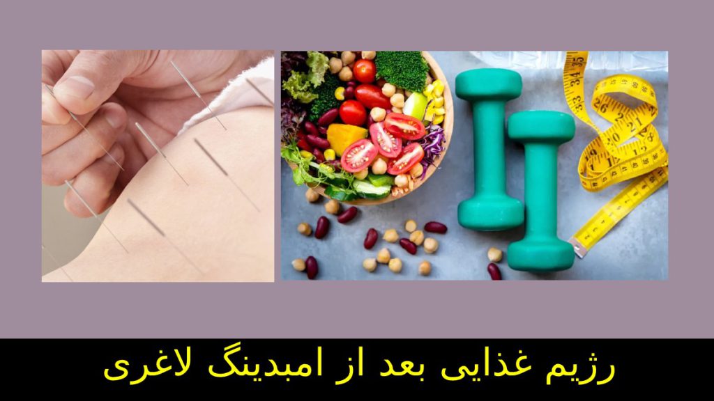 رعایت رژیم غذایی بعد از امبدینگ کسی که با روش لاغری امبدینگ کاهش وزن داشته باید رژی غذایی داشته باشد