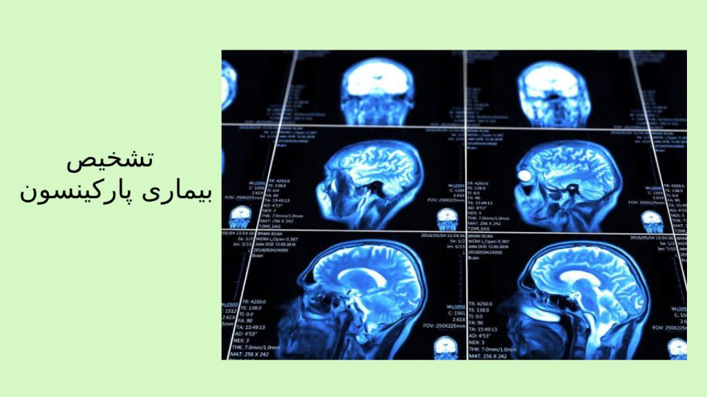 ام ار ای  بیماری که پارکینسون دارد