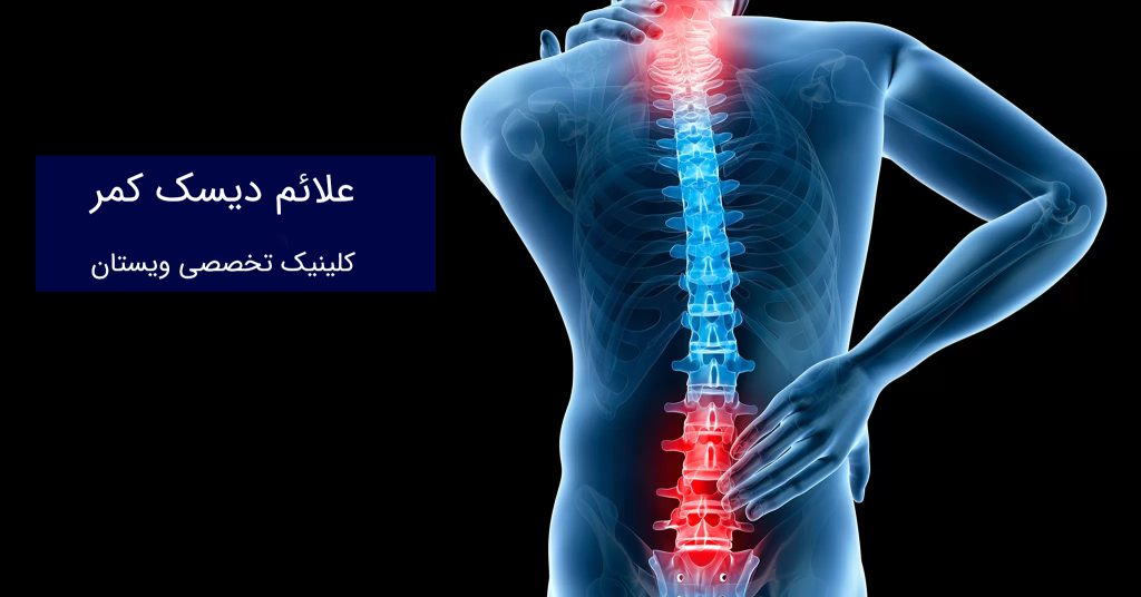 علائم دیسک کمر کدامند؟