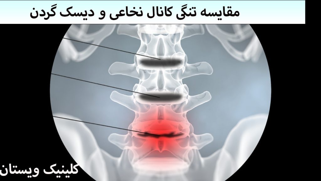 مهره های گردن انسان