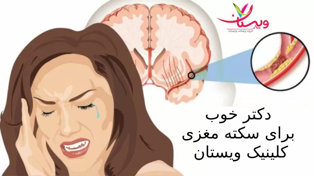 خانمی که دچار حمله مغزی شده است