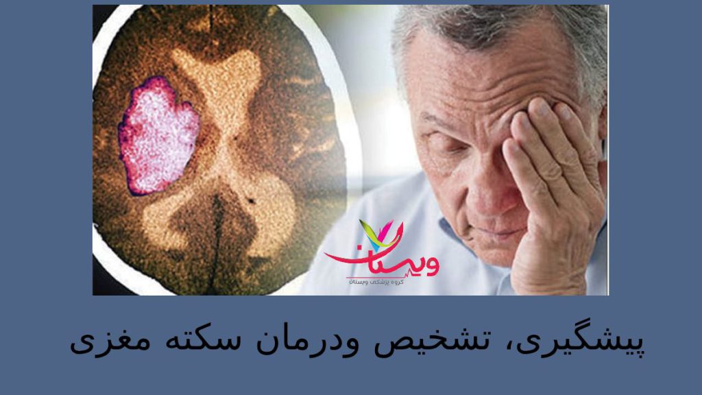 اقایی که علائم سکته خاموش را دارد ودستش را روی سرش گذاشته