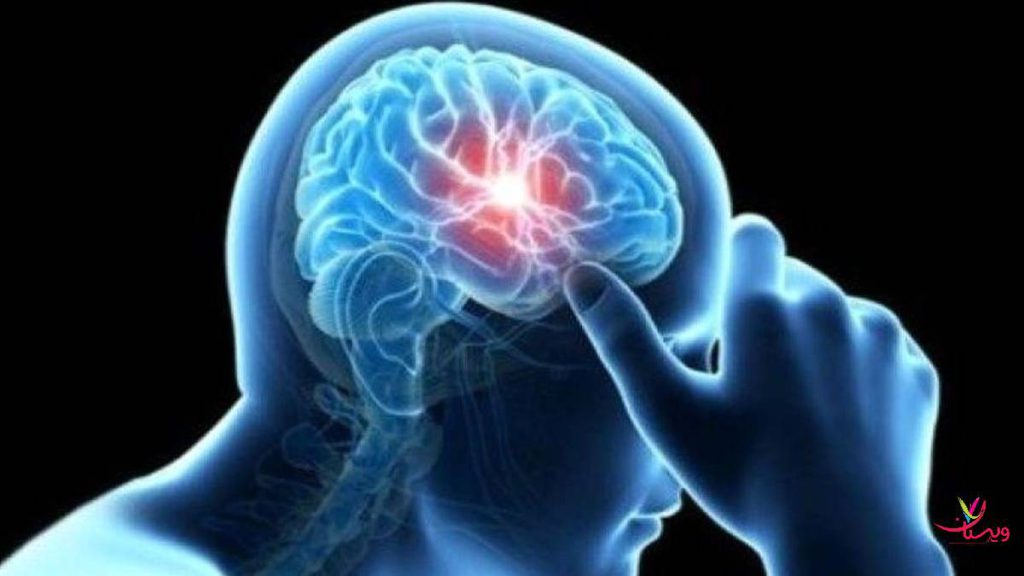 آتروفی مغز
